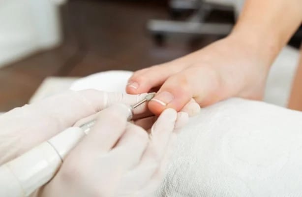 Pedicura - Tratamiento estética Callosa d'en Sarrià